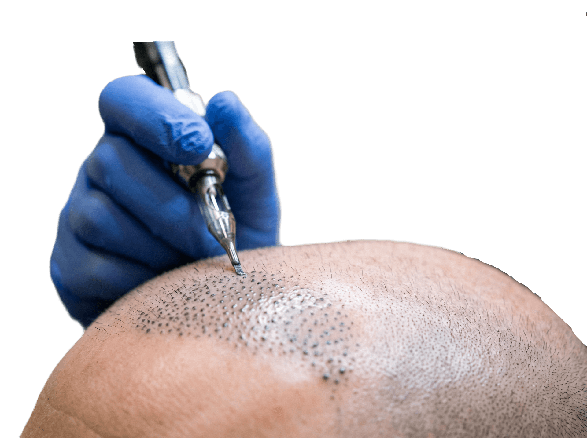 Trichopigmentation