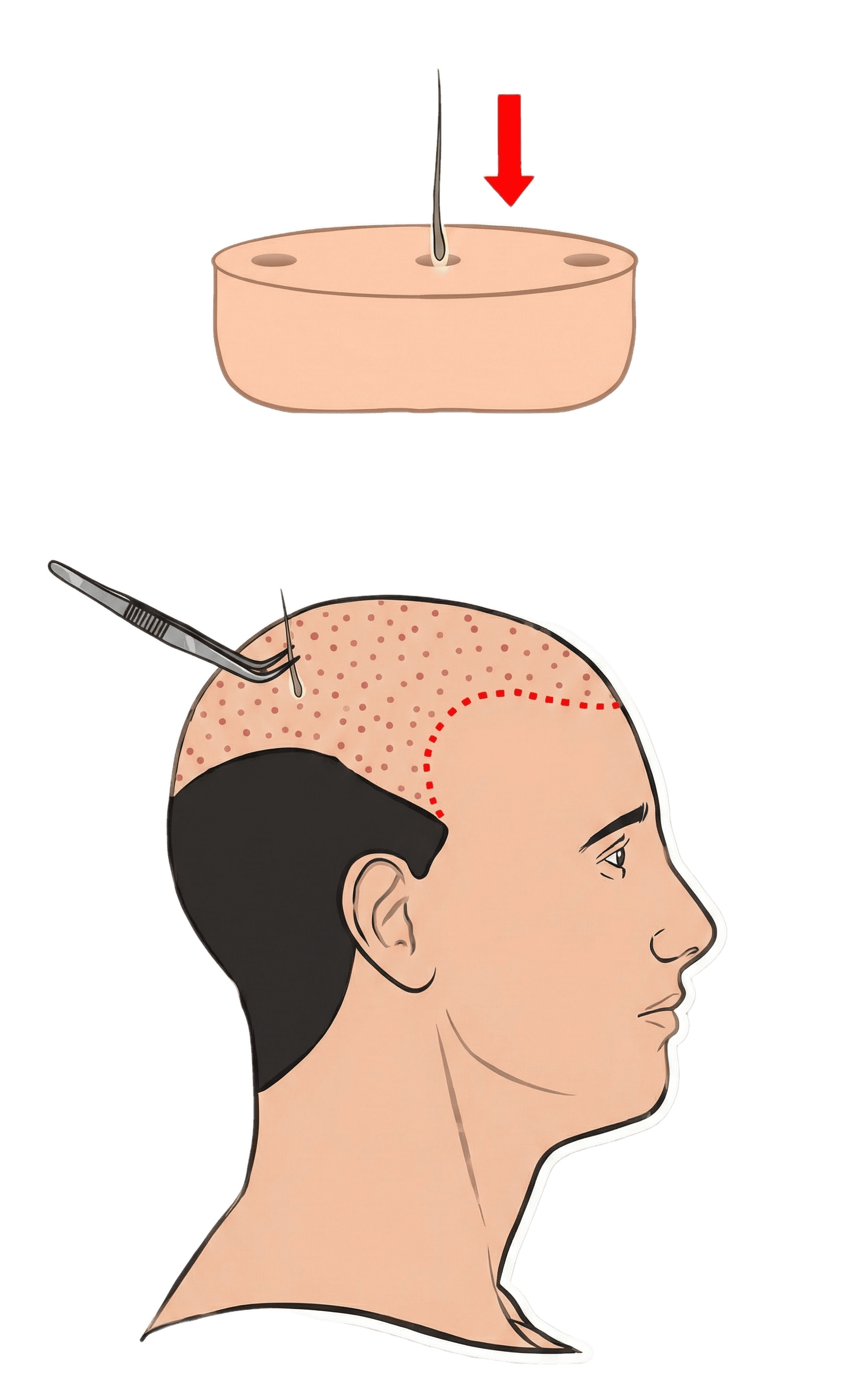 Ouverture des canaux Saphir